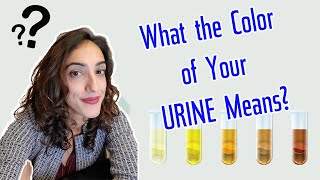 What does the COLOR of your URINE mean  A Urologist Explains [upl. by Adelaida]