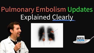 Pulmonary Embolism  Thromboembolism Updates Explained Clearly [upl. by Graniah125]