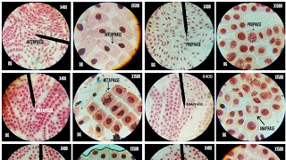 Onion root tip cell division stages at different magnificationsX400X675 amp X1500 [upl. by Aisac]