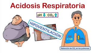 INTERPRETACIÓN DE LA GASOMETRÍA EN 4 PASOS 💉💉 con EJERCICIOS de PRÁCTICA al final del video [upl. by Ylebmik]