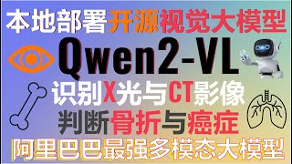 超越GPT4o视觉能力？本地部署Qwen2VL多模态视觉大模型！超越人类的视觉理解能力，精准识别X光片判断骨折、CT扫描检测癌症，还能识别手写体汉字与英文！qwen2 aigc ai [upl. by Aicaca570]