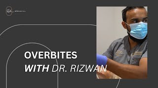 Why You Should Fix An Overbite With Dr Rizwan [upl. by Reinaldo]