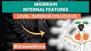 Midbrain Cross Sectional Anatomy  Internal features  level of Superior Colliculus [upl. by Sigmund487]