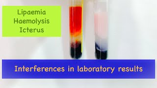 How lipaemia haemolysis and icterus interferes with laboratory results [upl. by Mandle337]