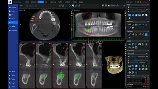 Romexis 6 Orientation [upl. by Tireb]