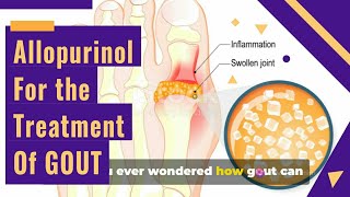 ALLOPURINOL Tablets ip 100mg AND GOUT Treatment [upl. by Zadack]