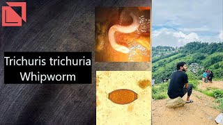 parasitology Trichuris trichura Whipworm norcet microbiology labtechnician mltlab [upl. by Ellirehs]