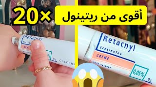 أخيرا جربت كريم retacnyl 005 🤩  كريم ريتاكنيل للوجه  retacnyl [upl. by Orbadiah134]