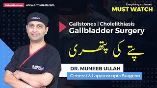 Gallstones  Cholelithiasis  Gallbladder Surgery  Everything explained MUST WATCH [upl. by Nahshunn416]