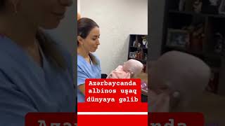 Azərbaycanda albinos uşaq dünyaya gəlib Bu barədə sosial şəbəkələrdə görüntülər yayılıb [upl. by Marven]