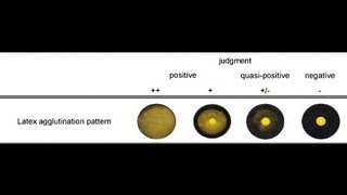 Latex Agglutination Test  Amrita University [upl. by Hogarth]