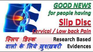 Good News for Slip Disc PIVD Sciatica  Research Based  स्लिप डिस्क  Cervical amp Low Back Pain [upl. by Eneli]