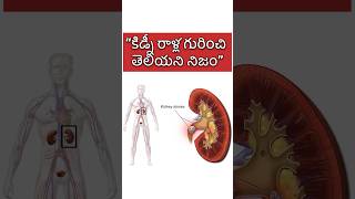 Unknown facts about kidney stones kidneystone telugufacts health [upl. by Einnil]