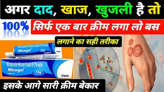 दाद खाज खुजली की बेस्ट क्रीम  micogel cream  micogel cream uses in hindi  miconazole nitrate [upl. by Mungovan677]