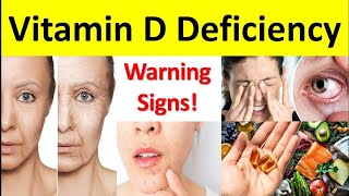 विटामिन D की कमी के 8 खतरनाक संकेत  Vitamin D Deficiency के Symptoms और उपाय  MK Biology [upl. by Yvor]