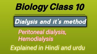 quotHemodialysis vs Peritoneal Dialysis Which is Right for YouquotExplained in Hindi and urdu [upl. by Derby]