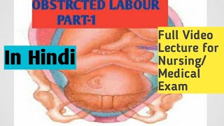 OBSTRUCTED LABOURII CAUSESSYMPTOMS DAIGNOSIS AND EFFECT PART1 II NIGHTIAGLE NURSING ACADEMY [upl. by Yauq]