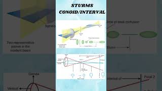 Astigmatism shortvideio viralshort ytshorts [upl. by Machos293]