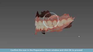 CS Imaging 31  software de aquisição do scanner intraoral CS3600 [upl. by Attesor332]