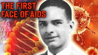 Before there was HIV there was Robert Rayford  short documentary [upl. by Ylecic]