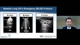 Implementation of the Bedside Lung Ultrasound in Emergency BLUE Protocol by Prehospital Paramedics [upl. by Marguerita]