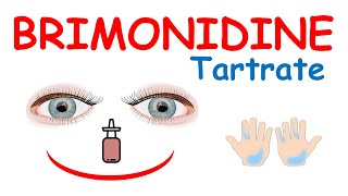 Brimonidine tartrate eye drops [upl. by Amalie888]