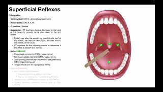 Deep Tendon Reflexes Stanford Medicine 25 [upl. by Missy343]