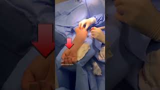 Sofrendo com problemas no nervo ulnar Descubra qual especialista procurar [upl. by Oel613]