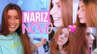 VLOG MINHA RINOPLASTIA CIRURGIA NO NARIZ [upl. by Fakieh365]