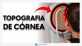 Topografia de córnea  DrGustavo Bonfadini [upl. by London]