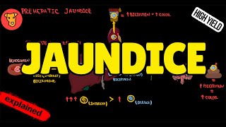 JAUNDICE Classification Pathogenesis Types of Jaundice Why urine is yellow [upl. by Lebasiram949]