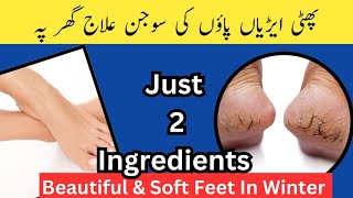 Crack Heels Treatment at Home پھٹی ایڑیاں بنائیں نرم و نازک اب گھر پہ [upl. by Wichman]