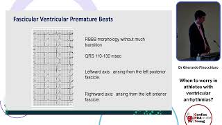 When to worry in athletes with ventricular arrhythmias  Dr Gherardo Finocchiaro [upl. by Anattar]