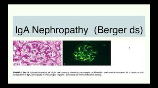 IgA Nephropathy  Berger disease [upl. by Larissa494]