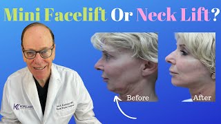 Reasons for a Mini Facelift or Neck Lift Surgery  Plastic Surgeons Opinion [upl. by Assehc]