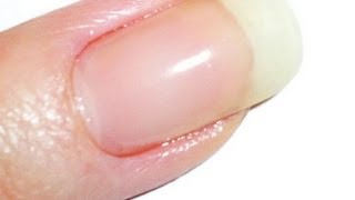 Vitagel LEDUV Gel to Repair Cracked Nails [upl. by Denzil]