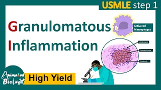 Granulomatous inflammation  What causes granulomatous inflammation  Pathology for USMLE step 1 [upl. by Milde]