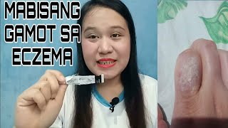 MABISANG GAMOT SA ECZEMA ECZEMA TREATMENT  CAUSE AND SOLUTION [upl. by Yenolem]