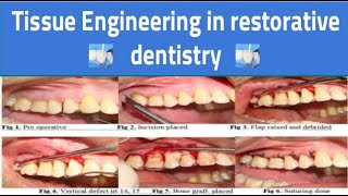 Tissue Engineering in Restorative Dentistry [upl. by Anaytat760]