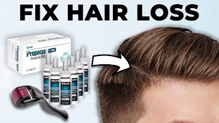 Men How To Fix Hair Loss At Home Full Guide [upl. by Onoitna]