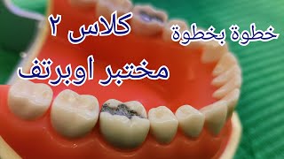 مختبر الاوبرتف تحضير حشوة كلاس ٢ preparation of amalgam filling cl II [upl. by Biebel]