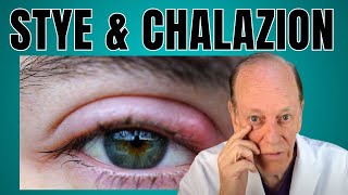 How a Plastic Surgeon Treats a Stye amp Chalazion [upl. by Siroval]