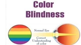 colour blindnessY linked traits [upl. by Yelrahc47]