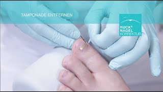 Hilfe für nahezu jeden Problemnagel  RUCK® NAGELKORREKTUR  GOLDSTADT professional Klebespange [upl. by Anniroc306]