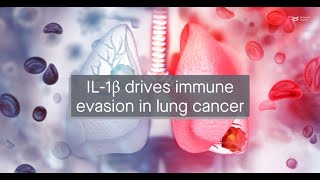 IL1β upregulates immune checkpoint regulators to promote immune evasion in lung adenocarcinoma [upl. by Ahsiel]