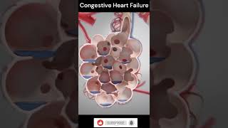 Congestive Heart Failure Explain 3DAnimation shorts [upl. by Tertius]