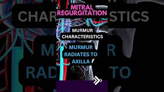 MITRAL REGURGITATION MURMURshorts [upl. by Romano]