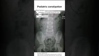 Pediatric constipation [upl. by Enomahs]