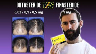 Diferentes Dosis De Dutasteride Vs Finasteride [upl. by Intruok372]