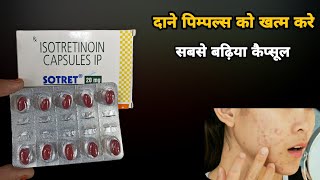 sotret 20 mg for acne reviews  बेस्ट कैप्सूल isotretinoin capsules ip 20 mg  sotret 10 mg reviews [upl. by Nomla]